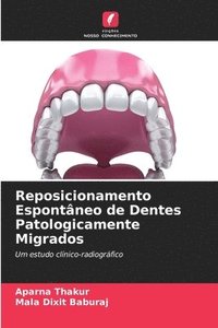bokomslag Reposicionamento Espontaneo de Dentes Patologicamente Migrados