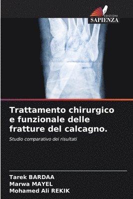 Trattamento chirurgico e funzionale delle fratture del calcagno. 1