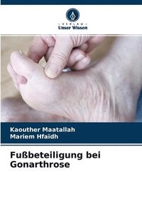 bokomslag Fubeteiligung bei Gonarthrose