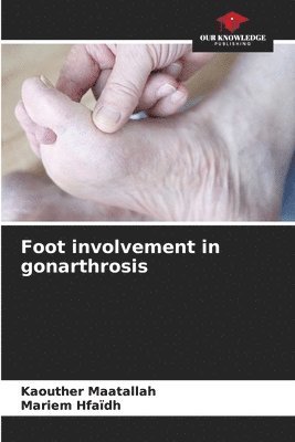 Foot involvement in gonarthrosis 1