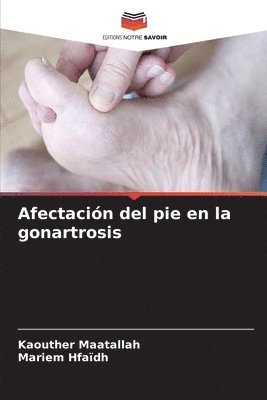 Afectacin del pie en la gonartrosis 1