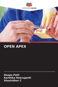 bokomslag Open Apex