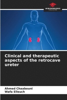 Clinical and therapeutic aspects of the retrocave ureter 1