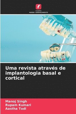 bokomslag Uma revista atravs de implantologia basal e cortical
