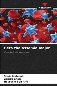 bokomslag Beta thalassemia major