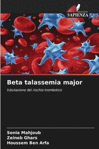 bokomslag Beta talassemia major