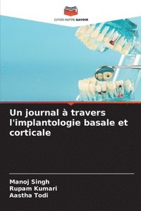 bokomslag Un journal  travers l'implantologie basale et corticale