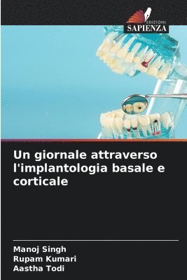 bokomslag Un giornale attraverso l'implantologia basale e corticale