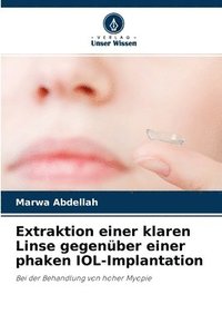 bokomslag Extraktion einer klaren Linse gegenuber einer phaken IOL-Implantation