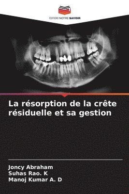 bokomslag La rsorption de la crte rsiduelle et sa gestion