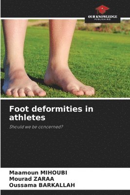 Foot deformities in athletes 1