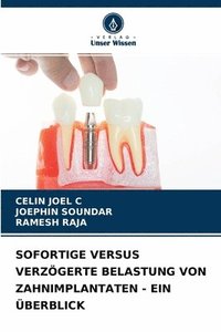 bokomslag Sofortige Versus Verzgerte Belastung Von Zahnimplantaten - Ein berblick