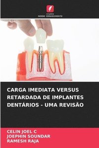 bokomslag Carga Imediata Versus Retardada de Implantes Dentrios - Uma Reviso