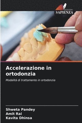 Accelerazione in ortodonzia 1