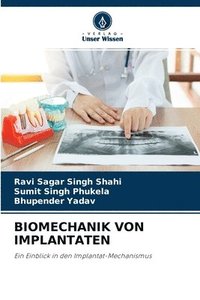 bokomslag Biomechanik Von Implantaten