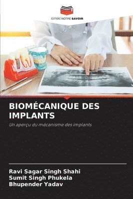 bokomslag Biomcanique Des Implants