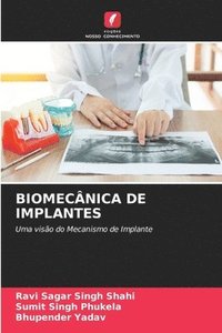 bokomslag Biomecnica de Implantes