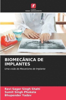 Biomecnica de Implantes 1