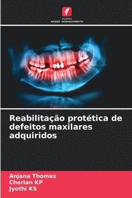 bokomslag Reabilitacao protetica de defeitos maxilares adquiridos