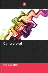 bokomslag Cancro oral