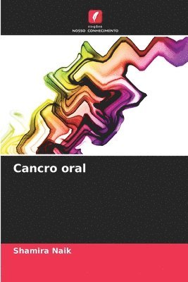Cancro oral 1