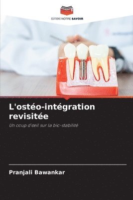 L'osteo-integration revisitee 1