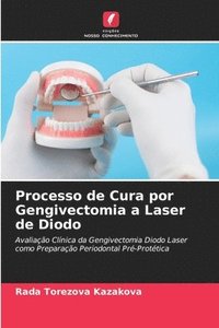bokomslag Processo de Cura por Gengivectomia a Laser de Diodo