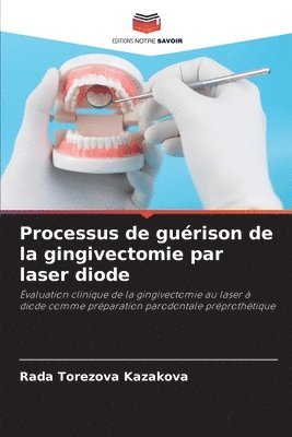bokomslag Processus de gurison de la gingivectomie par laser diode