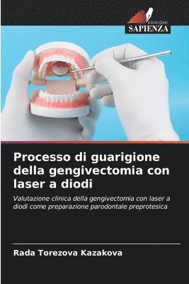 Processo di guarigione della gengivectomia con laser a diodi 1