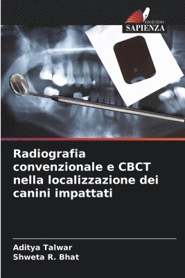 Radiografia convenzionale e CBCT nella localizzazione dei canini impattati 1