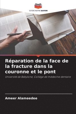 bokomslag Rparation de la face de la fracture dans la couronne et le pont