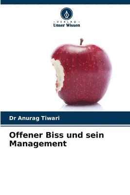 bokomslag Offener Biss und sein Management