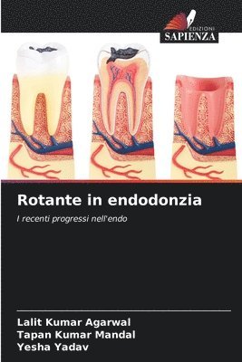 Rotante in endodonzia 1