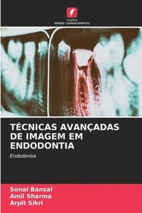 bokomslag Tcnicas Avanadas de Imagem Em Endodontia