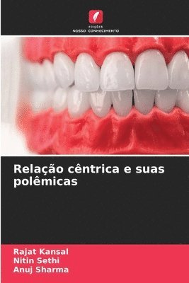 bokomslag Relação cêntrica e suas polêmicas