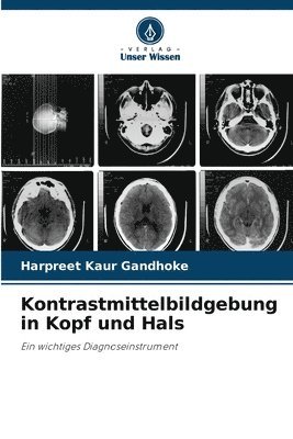 bokomslag Kontrastmittelbildgebung in Kopf und Hals