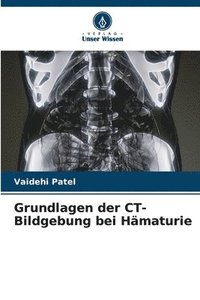 bokomslag Grundlagen der CT-Bildgebung bei Hmaturie