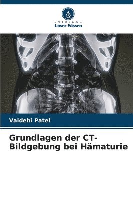 Grundlagen der CT-Bildgebung bei Hmaturie 1