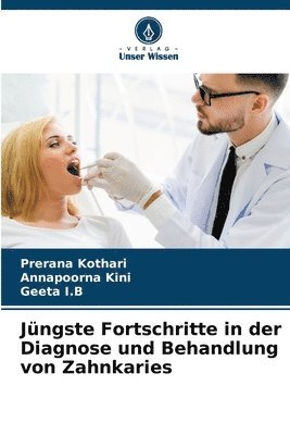 bokomslag Jngste Fortschritte in der Diagnose und Behandlung von Zahnkaries