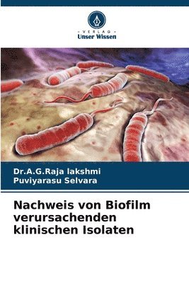 Nachweis von Biofilm verursachenden klinischen Isolaten 1