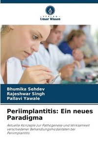 bokomslag Periimplantitis