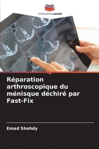 bokomslag Rparation arthroscopique du mnisque dchir par Fast-Fix