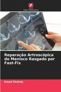 bokomslag Reparao Artroscpica do Menisco Rasgado por Fast-Fix