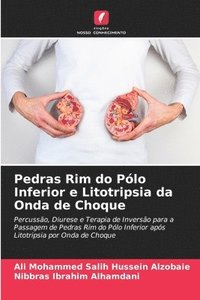 bokomslag Pedras Rim do Plo Inferior e Litotripsia da Onda de Choque