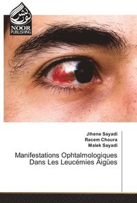 bokomslag Manifestations Ophtalmologiques Dans Les Leucmies Aiges