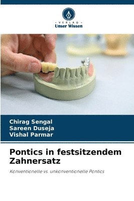 Pontics in festsitzendem Zahnersatz 1