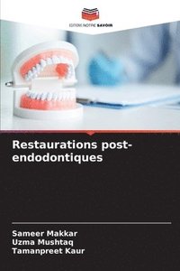 bokomslag Restaurations post-endodontiques