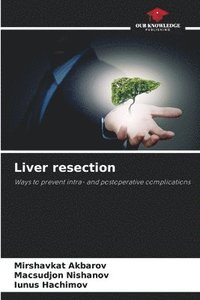 bokomslag Liver resection