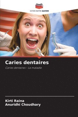 Caries dentaires 1