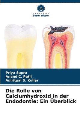 Die Rolle von Calciumhydroxid in der Endodontie 1